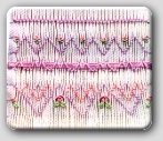 Little Stitches
